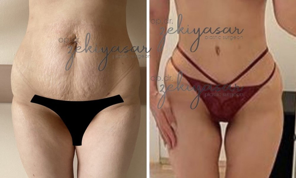 Slider image (5) Dr. Zeki Yasar Clinic